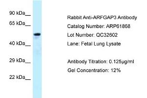 Western Blotting (WB) image for anti-ADP-Ribosylation Factor GTPase Activating Protein 3 (ARFGAP3) (C-Term) antibody (ABIN2788930) (ARFGAP3 抗体  (C-Term))