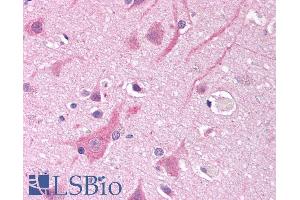 ABIN185467 (10µg/ml) staining of paraffin embedded Human Cortex. (SCN5A 抗体  (Internal Region))