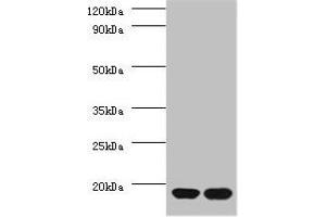 Western blot All lanes: RPS13 antibody at 2 μg/mL Lane 1: EC109 whole cell lysate Lane 2: 293T whole cell lysate Secondary Goat polyclonal to rabbit IgG at 1/15000 dilution Predicted band size: 18 kDa Observed band size: 18 kDa (RPS13 抗体  (AA 3-151))