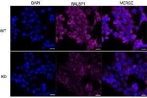 Immunocytochemical staining of HeLa cells using RALBP1 antibody (ABIN7800126), 1:1,000), Top panel: wild-type (WT), Bottom panal: RALBP1 shRNA knockdown (KD). (Recombinant RALBP1 抗体)