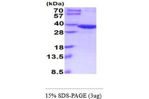 SDS-PAGE (SDS) image for Glycine N-Methyltransferase (GNMT) (AA 1-295) (Active) protein (His tag) (ABIN6388114) (GNMT Protein (AA 1-295) (His tag))