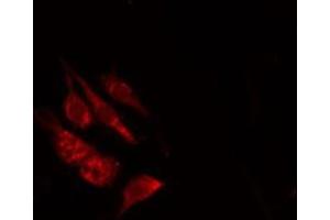 anti-OR8B2/B3 antibody