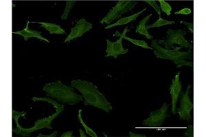 Immunofluorescence (IF) image for anti-Plastin 3 (PLS3) (AA 1-630) antibody (ABIN948273)