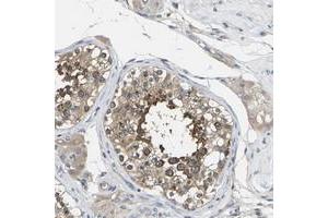 Immunohistochemical staining of human testis with TMCC2 polyclonal antibody  shows strong cytoplasmic positivity in cells in seminiferus ducts. (TMCC2 抗体)