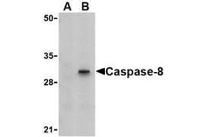 Western blot analysis of Caspase-8 in HT-29 cell lysate with AP30204PU-N Caspase-8 antibody (IN) at 1 μg/ml in (A) the presence or (B) the absence of blocking peptide. (Caspase 8 抗体)