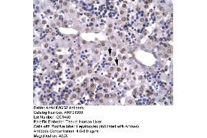 Human Liver (HMGB2 抗体  (C-Term))