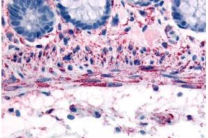 Human Smooth Muscle Cells (formalin-fixed, paraffin-embedded) stained with ADRA1B antibody ABIN213529 at 10 ug/ml followed by biotinylated goat anti-rabbit IgG secondary antibody ABIN481713, alkaline phosphatase-streptavidin and chromogen. (ADRA1B 抗体  (C-Term))