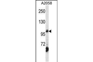 Western Blotting (WB) image for anti-Adaptor-Related Protein Complex 2, beta 1 Subunit (AP2B1) (AA 517-546) antibody (ABIN5535477)