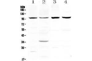 Western blot analysis of DYRK1A using anti-DYRK1A antibody . (DYRK1A 抗体  (AA 38-269))