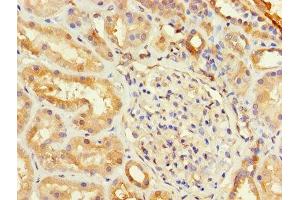 Immunohistochemistry of paraffin-embedded human kidney tissue using ABIN7153737 at dilution of 1:100 (TSTA3 抗体  (AA 1-314))