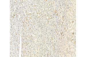 ABIN6260963 and ABIN6266517 at 1/100 staining Rat kidney tissue by IHC-P. (Connexin 43/GJA1 抗体  (Internal Region))