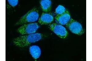 IF analysis of TIMM8A/DDP using anti-TIMM8A/DDP antibody (ABIN7600039). (TIMM8A/DDP 抗体  (AA 14-97))