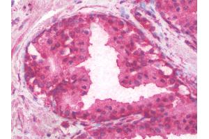 anti-SERPINE1 mRNA Binding Protein 1 (SERBP1) antibody