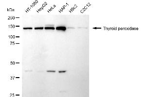 anti-Thyroid Peroxidase (TPO) antibody