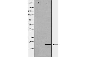 Western blot analysis of HepG2 cell lysate, using ISG15 Antibody. (ISG15 抗体  (C-Term))