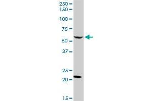 CAMKK2 MaxPab rabbit polyclonal antibody. (CAMKK2 抗体  (AA 1-541))