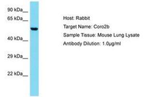 Image no. 1 for anti-Coronin, Actin Binding Protein, 2B (CORO2B) (AA 62-111) antibody (ABIN6750330) (CORO2B 抗体  (AA 62-111))