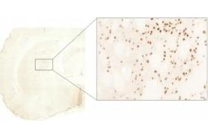 Immunohistochemistry (IHC) image for anti-Huntingtin (HTT) (AA 85-200) antibody (ABIN6254174) (Huntingtin 抗体  (AA 85-200))