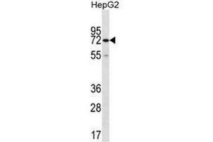 CTPS2 Antibody (C-term) western blot analysis in HepG2 cell line lysates (35µg/lane). (CTPS2 抗体  (C-Term))