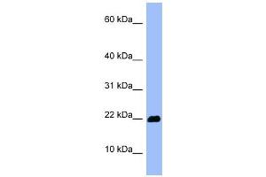 OMP antibody used at 1 ug/ml to detect target protein. (OMP 抗体  (Middle Region))