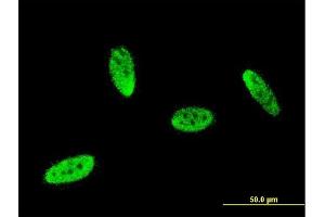 Immunofluorescence of monoclonal antibody to SOX8 on HeLa cell. (SOX8 抗体  (AA 102-210))