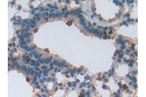 Immunohistochemistry (IHC) image for anti-Plastin 3 (PLS3) (AA 5-251) antibody (ABIN7439222)