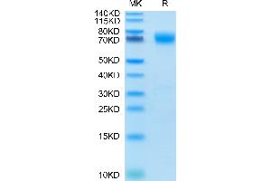 CD276 Protein (CD276) (AA 29-465) (His tag)