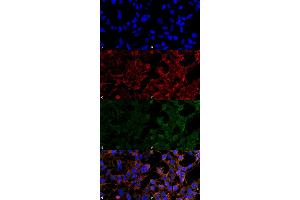 Immunocytochemistry/Immunofluorescence analysis using Mouse Anti-4-Hydroxynonenal Monoclonal Antibody, Clone 12F7 . (HNE 抗体  (APC))