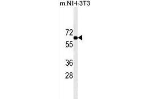 Western Blotting (WB) image for anti-Ribosomal Protein S6 Kinase, 70kDa, Polypeptide 2 (RPS6KB2) antibody (ABIN2909954) (RPS6KB2 抗体)
