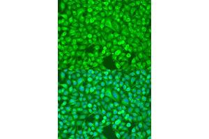 Immunofluorescence analysis of U2OS cells using NFKB2 antibody. (NFKB2 抗体  (AA 690-899))