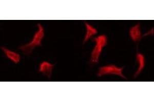 ABIN6275551 staining COLO205 by IF/ICC. (PPP4R1L 抗体)