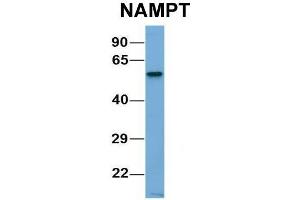 Host:  Rabbit  Target Name:  CHAD  Sample Type:  Human Adult Placenta  Antibody Dilution:  1. (NAMPT 抗体  (C-Term))