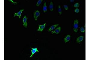 Immunofluorescence (IF) image for anti-Phosphatidic Acid Phosphatase Type 2C (PPAP2C) (AA 109-162) antibody (ABIN7163353)