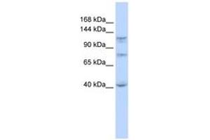 Image no. 1 for anti-DEAH (Asp-Glu-Ala-His) Box Polypeptide 30 (DHX30) (N-Term) antibody (ABIN6742683) (DHX30 抗体  (N-Term))