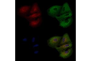 ABIN6258500 and ABIN6274589 staining  cells by IF/ICC. (ARRDC3 抗体  (C-Term))