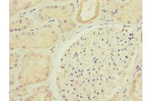 Immunohistochemistry (IHC) image for anti-Cadherin 1, Type 1, E-Cadherin (Epithelial) (CDH1) (AA 20-260) antibody (ABIN7146199)