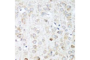 Immunohistochemistry of paraffin-embedded mouse brain using ANKRD52 antibody. (ANKRD52 抗体  (AA 450-660))