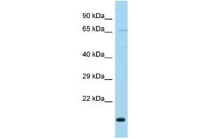 WB Suggested Anti-TIMM23B Antibody Titration: 1. (TIMM23B 抗体  (N-Term))