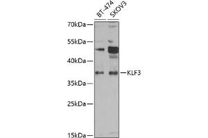 Western blot analysis of extracts of various cell lines, using KLF3 antibody (ABIN6130892, ABIN6142918, ABIN6142919 and ABIN6223018) at 1:1000 dilution.