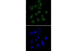 Immunofluorescence analysis of HeLa cells using CHD3 monoclonal antibody, clone 2G4  (green). (CHD3 抗体)