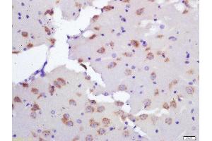 Formalin-fixed and paraffin embedded rat brain labeled with Rabbit Anti-Ceramide synthase 2 Polyclonal Antibody, Unconjugated  at 1:200 followed by conjugation to the secondary antibody and DAB staining (Ceramide Synthase 2 抗体  (AA 201-300))