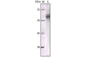 Western blot analysis using CK mouse mAb against truncated CK5 recombinant protein. (pan Keratin 抗体)