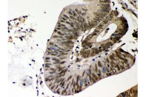 Immunohistochemistry (IHC) image for anti-Casein Kinase 1, alpha 1 (CSNK1A1) (AA 30-68), (N-Term) antibody (ABIN3042767)