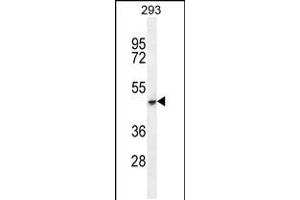 Western blot analysis in 293 cell line lysates (35ug/lane). (COCH 抗体  (C-Term))