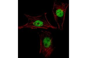 Immunofluorescence (IF) image for anti-Mesenchyme Homeobox 2 (MEOX2) antibody (ABIN3000188) (MEOX2 抗体)