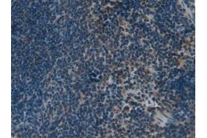 Detection of KLK4 in Mouse Spleen Tissue using Polyclonal Antibody to Kallikrein 4 (KLK4) (Kallikrein 4 抗体  (AA 32-255))