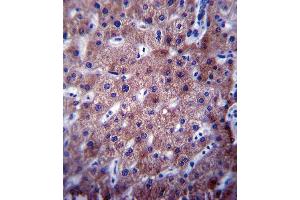 CYP2C19 Antibody (Center) (ABIN390665 and ABIN2840960) immunohistochemistry analysis in formalin fixed and paraffin embedded human liver tissue followed by peroxidase conjugation of the secondary antibody and DAB staining. (CYP2C19 抗体  (AA 257-285))