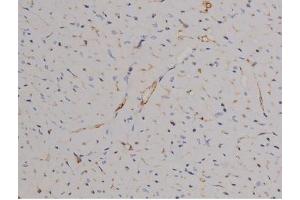 Immunohistochemistry (IHC) image for anti-Signal Transducer and Activator of Transcription 6, Interleukin-4 Induced (STAT6) (pTyr641) antibody (ABIN6256781)