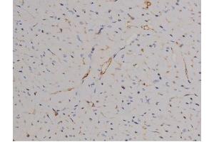 ABIN6267510 at 1/200 staining Mouse heart tissue sections by IHC-P. (STAT6 抗体  (pTyr641))