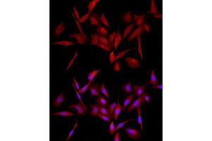 Immunofluorescence analysis of U2OS cells using MyD88 Rabbit pAb (ABIN3021213, ABIN3021214, ABIN3021215, ABIN1513232 and ABIN6214069) at dilution of 1:100 (40x lens). (MYD88 抗体  (AA 60-309))